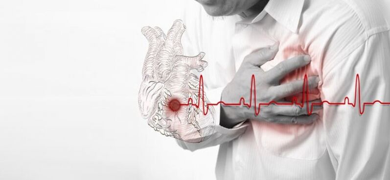 Atacul de cord ca cauză a durerii sub omoplatul stâng