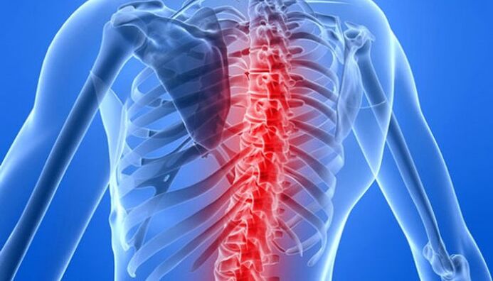 Patologiile coloanei vertebrale sunt cea mai frecventă cauză a durerilor de spate în zona scapulei