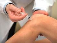 Injecție intra -karticulară