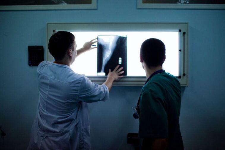 Diagnosticul de osteoartrită pe razele X