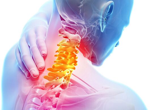 Osteocondroza cervicală