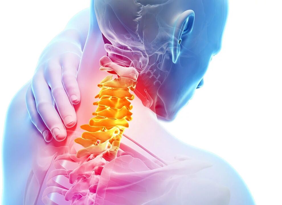 Osteocondroza cervicală