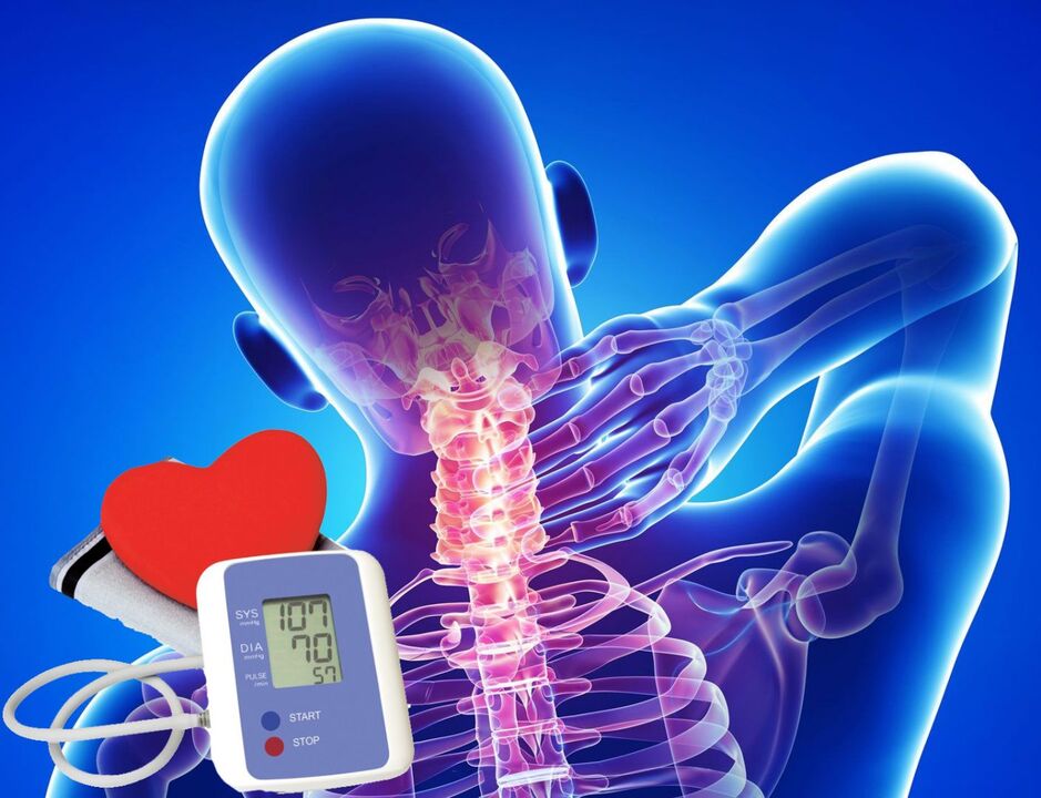 Sări ale tensiunii arteriale în osteocondroza cervicală
