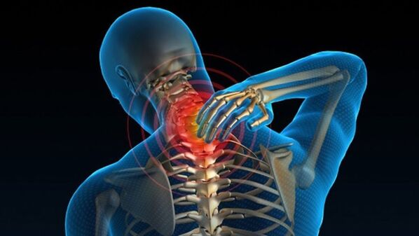 Durerea la întoarcerea gâtului poate indica sindromul de osteocondroză cervicală vertebrală