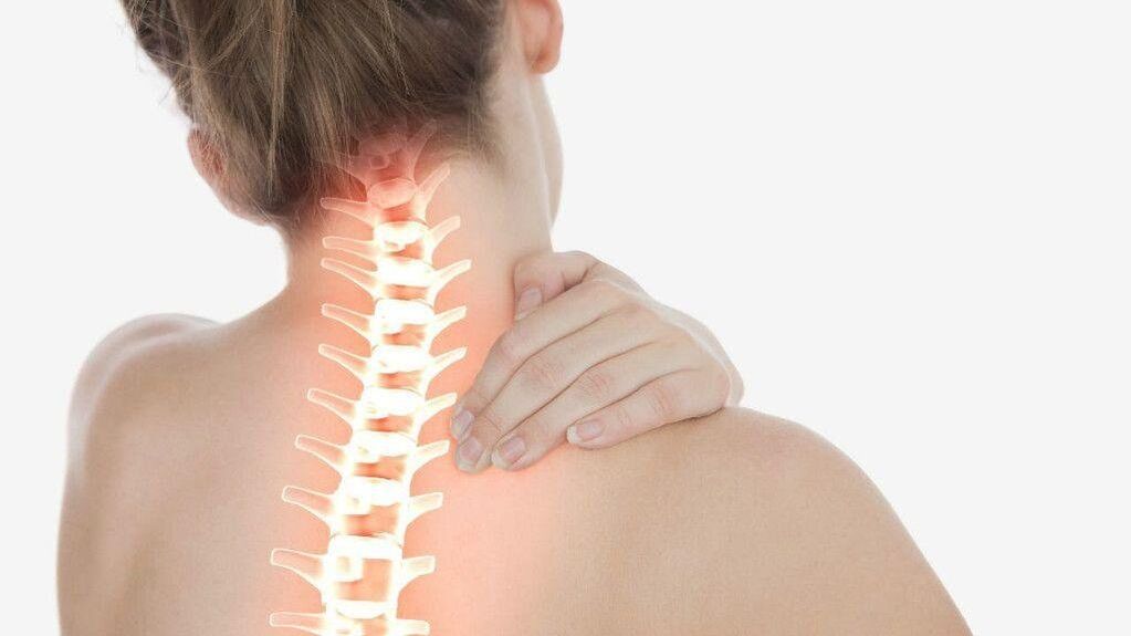 Sindromul radicular se poate dezvolta cu osteocondroza coloanei cervicale